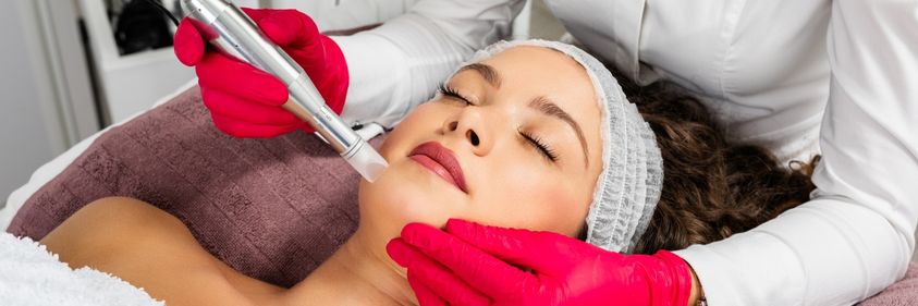 The Impressive Anti-Aging Benefits of Microneedling