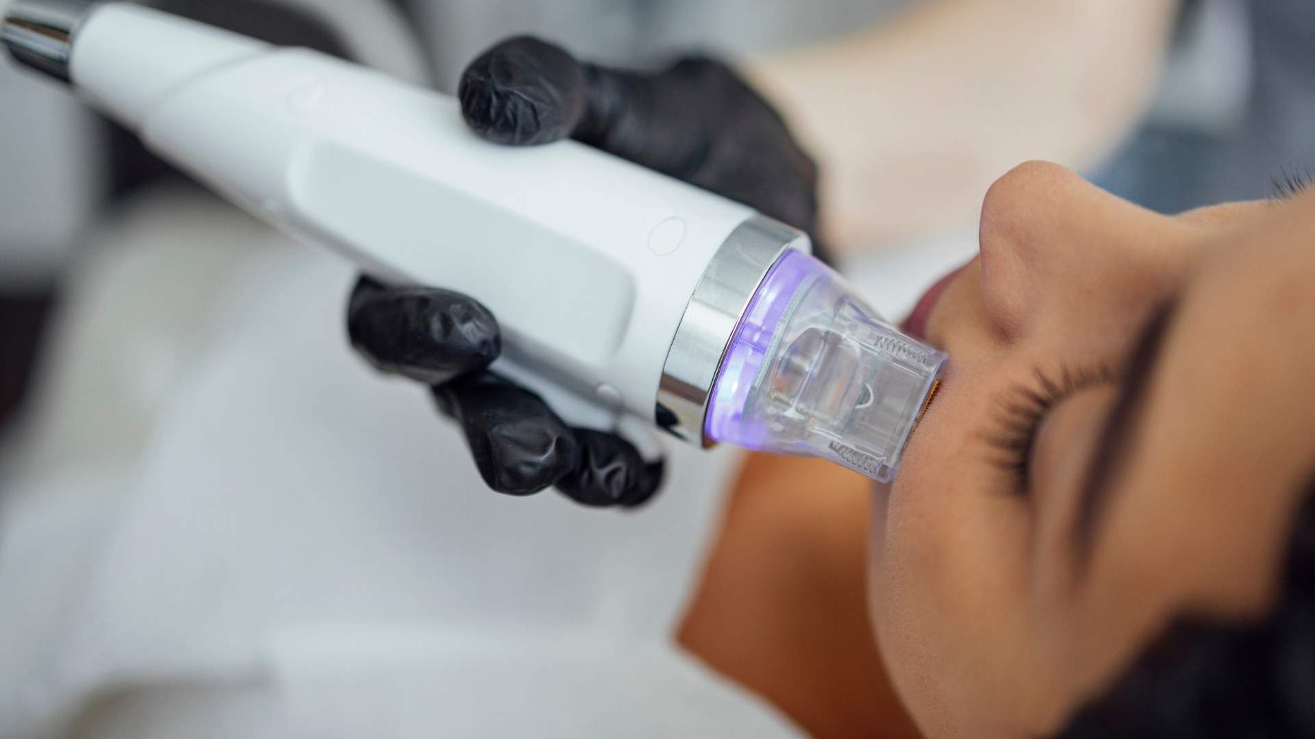 Microneedling Skincare Treatment