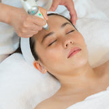 DermaPen Microneedling Treatment - VHB Skincare