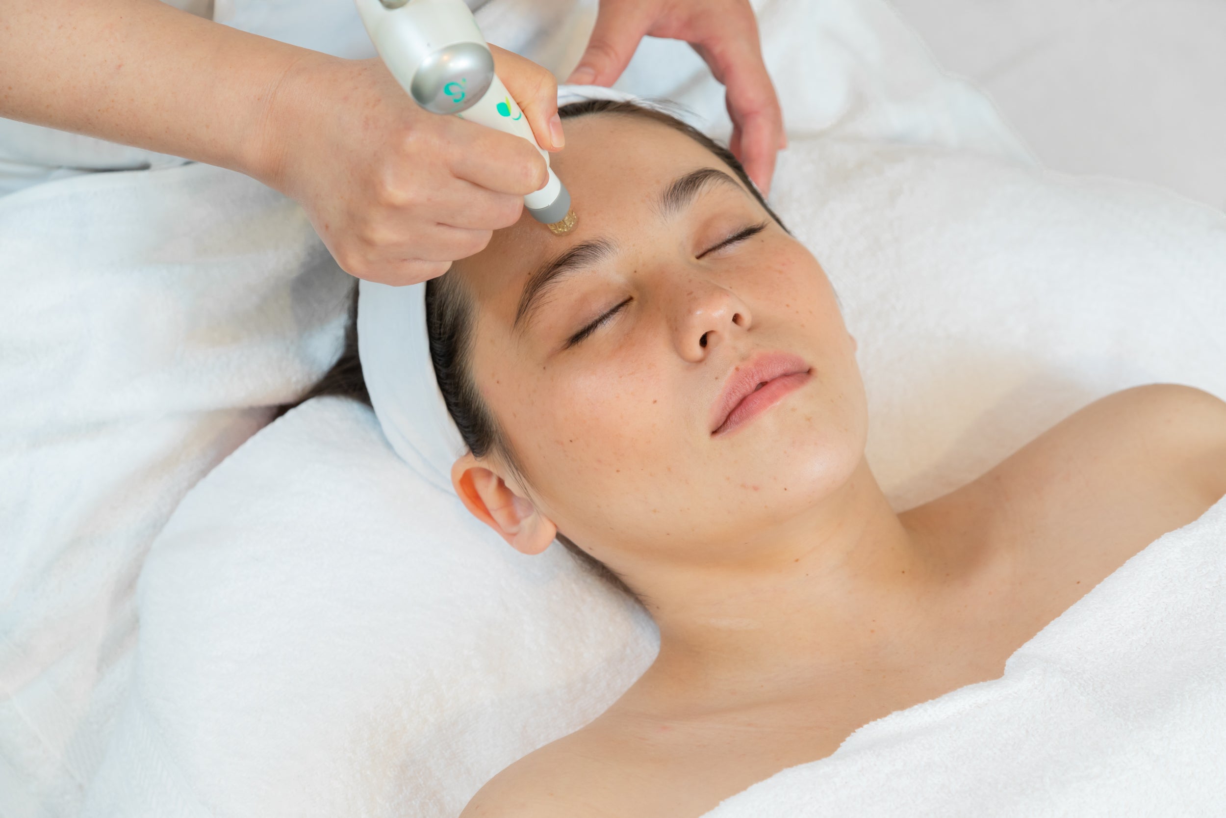 DermaPen Microneedling Treatment - VHB Skincare