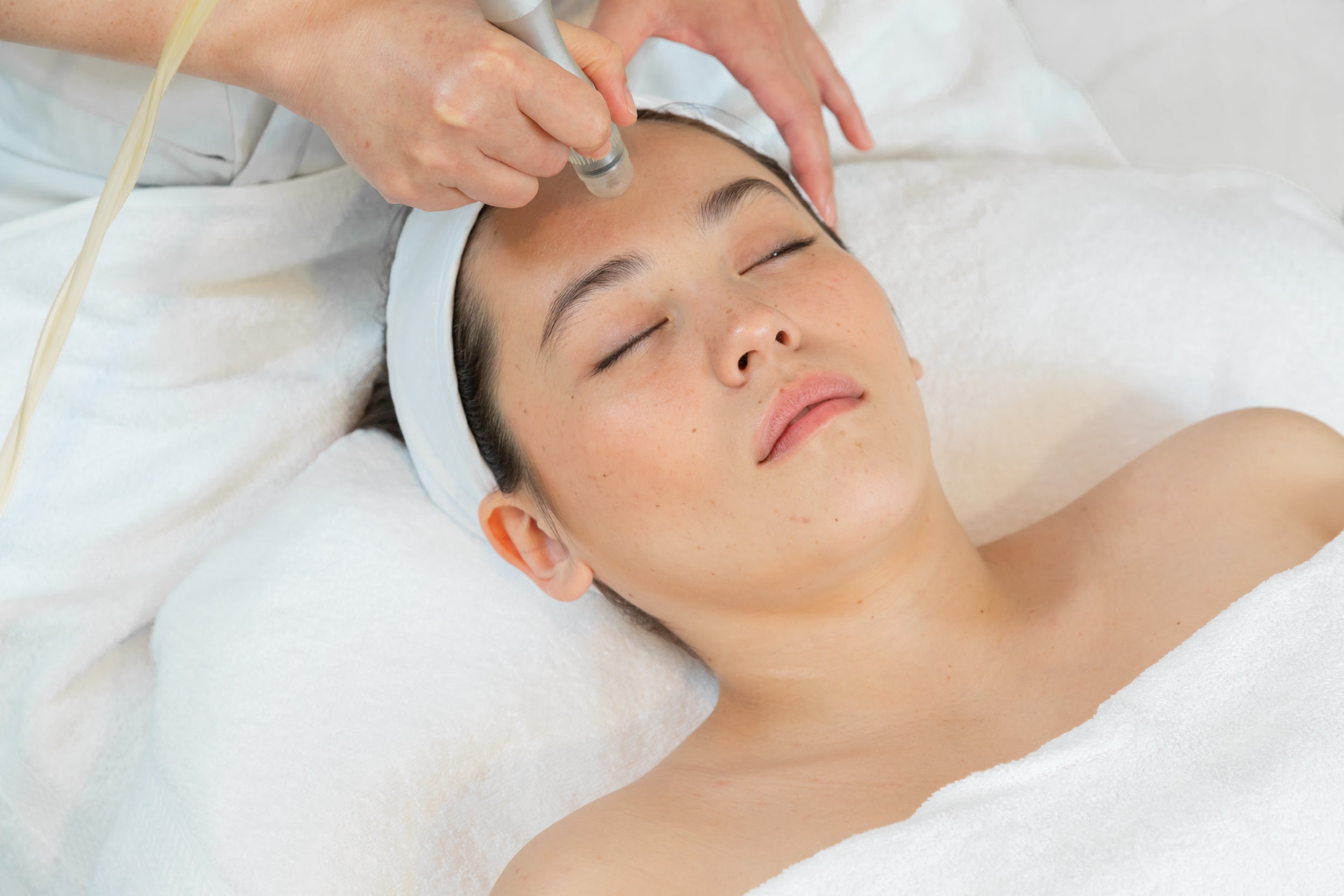 Microdermabrasion and Mini Cool with Yeast Extract - VHB Skincare