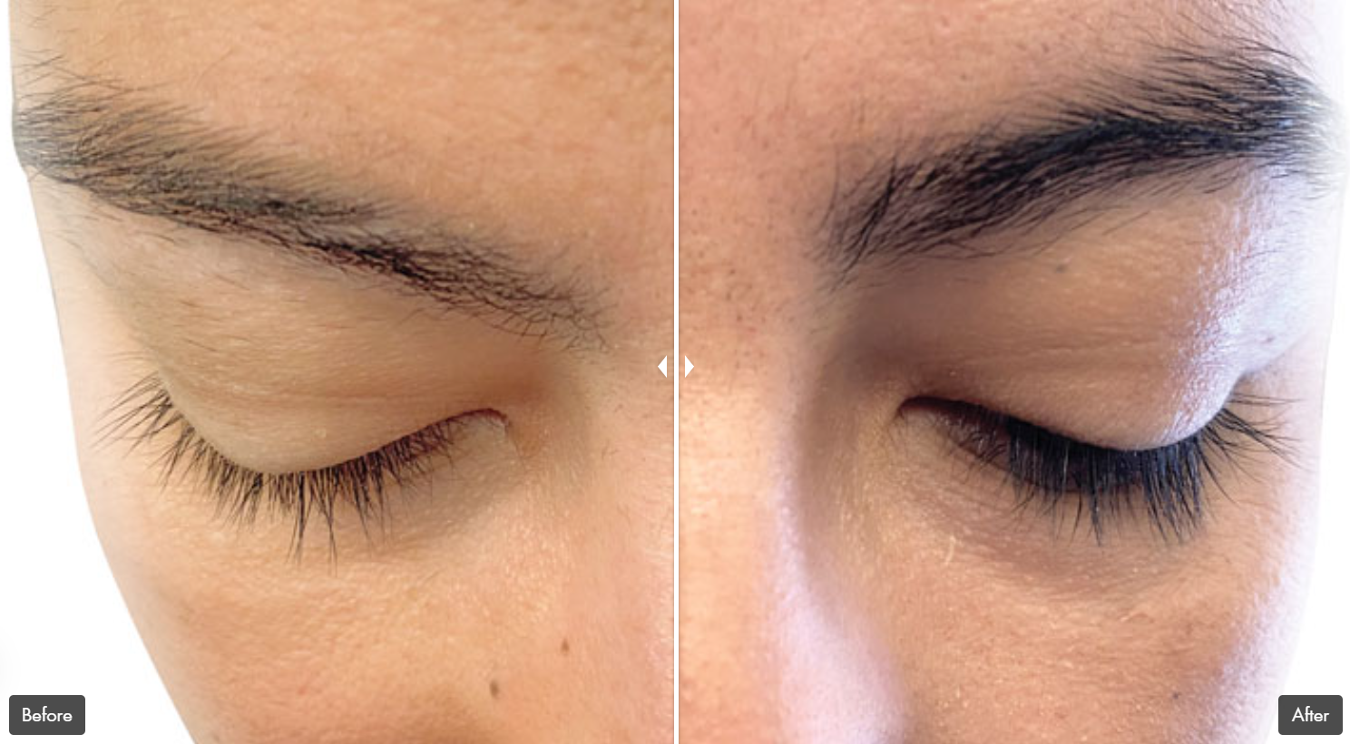 Rejuran Advanced Lash Enhancing Booster - VHB Skincare