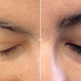 Rejuran Advanced Lash Enhancing Booster - VHB Skincare